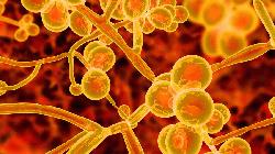 'Drug resistant fungal 'superbug' spreads in Dhaka ICU's' 