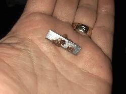 Razor blade found in DU hall canteen food
