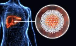 WHO: Bangladesh among top 10 countries for hepatitis C burden
