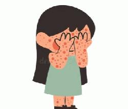 3 die with measles symptoms in 24 hours