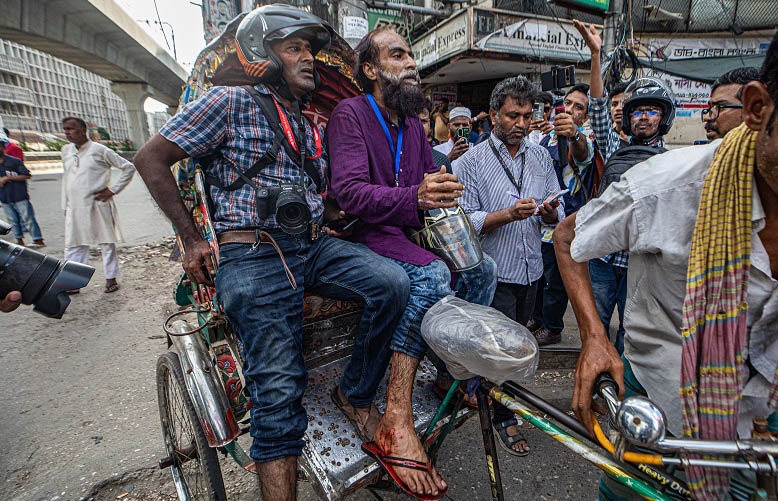 Photojournalists Khandaker Azizur Rahman alias AR Sumon (R) and Milon (L) were being taken to DMCH after sustaining bullet wounds. Photo: The Daily Observer